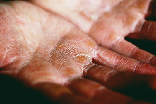 The Skin Barrier Is Bioenergetic: Why Traditional Soaps Disrupt It and What to Do About It